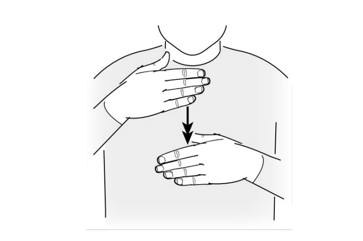 Bilden visar ordet drama på teckenspråk